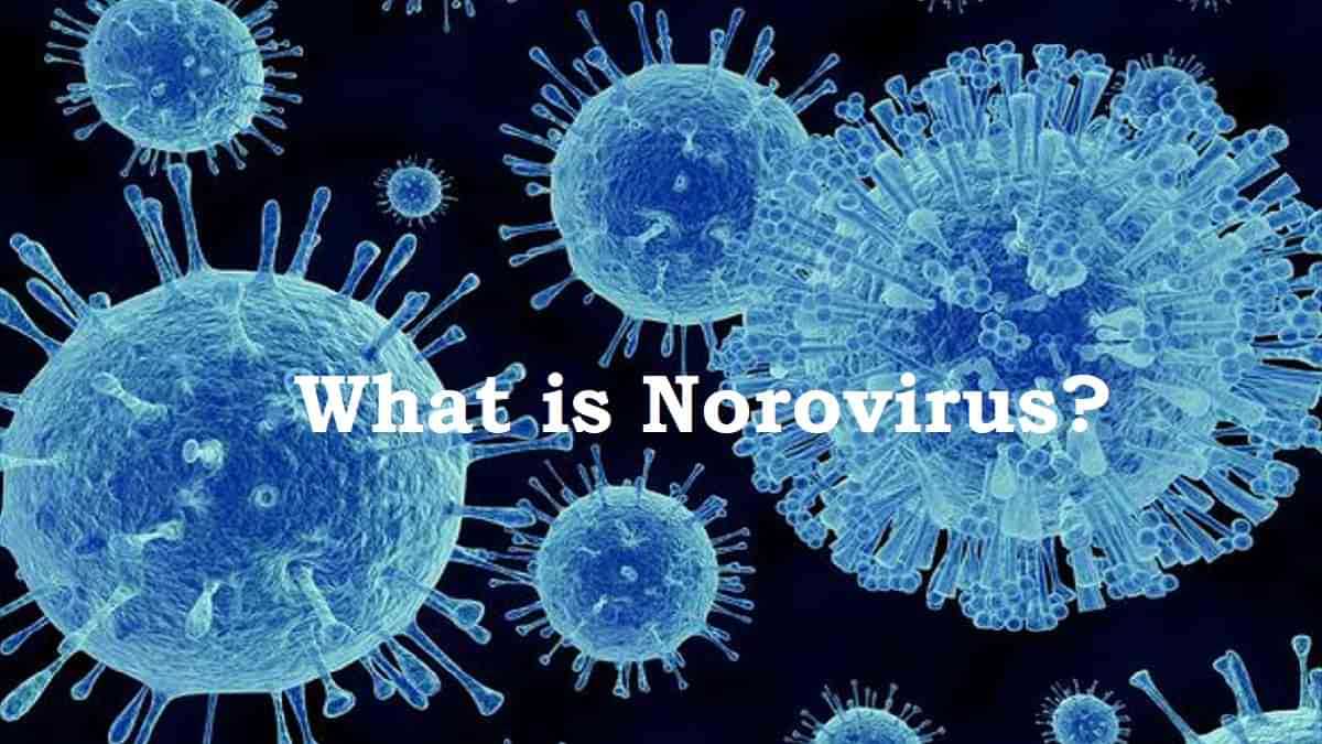 Norovirus in Kerala: Two children infected with Norovirus in Kerala, Know Norovirus Meaning, Symptoms and Treatment